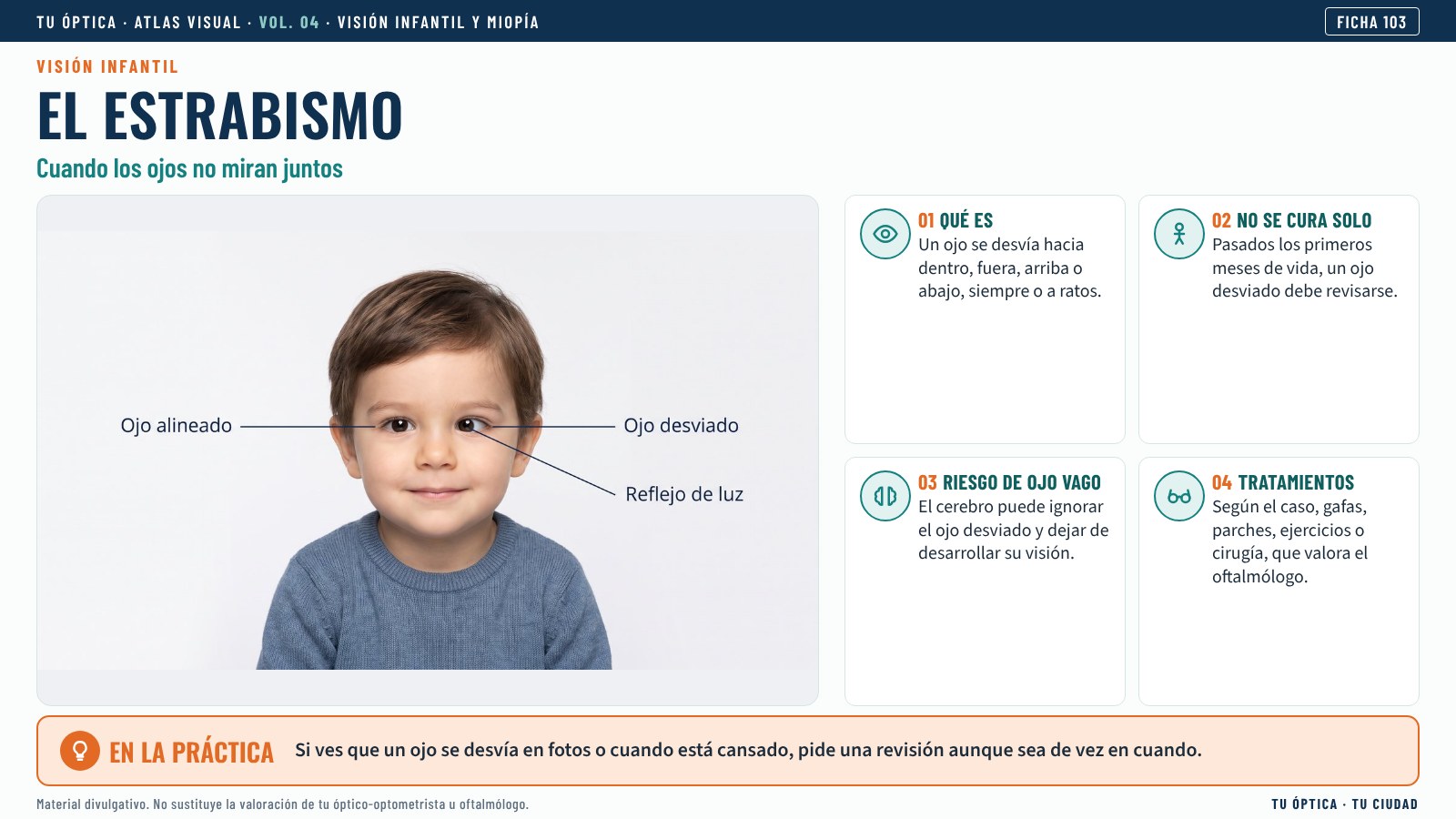 Ficha: estrabismo infantil